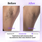 🟣Buy 1 Get 1 Free🧊💧Sensitive Skin Body Hair Removal Cream