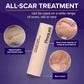 Skin Scar Solutions🛡️ 60%  Silicone Scar Stick.