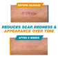 Skin Scar Solutions🛡️ 60%  Silicone Scar Stick.