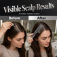 🔥 50% OFF! 💆 Instant Scalp Care – Precision Liquid Applicator Comb ✨